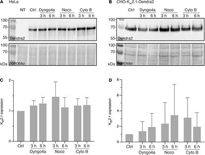 Quantitative Analysis of the Cytoskeleton’s Role in Inward Rectifier KIR2.1 Forward and Backward Trafficking